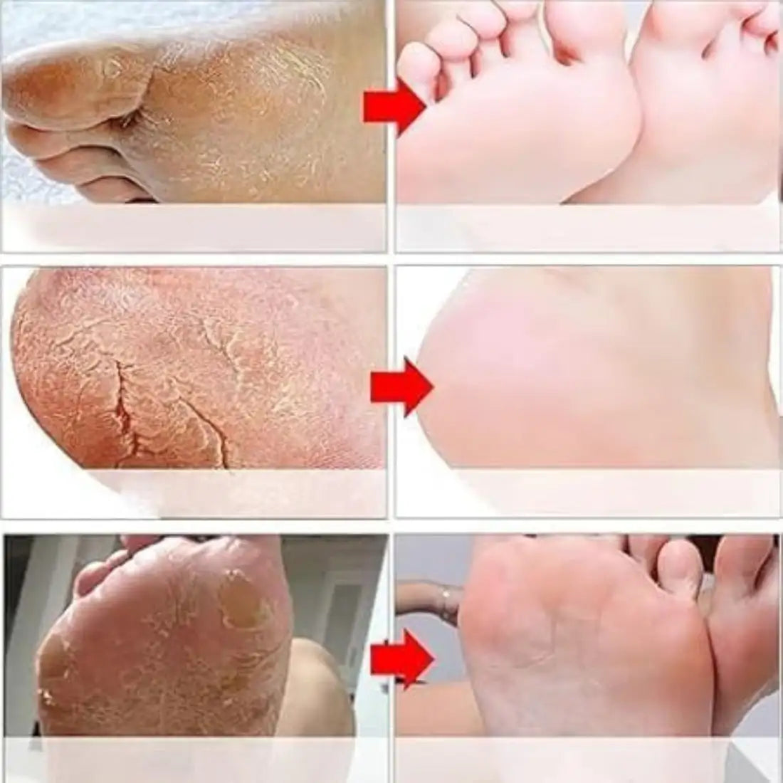 Goat Milk Exfoliating Foot Mask with Nicotinamide