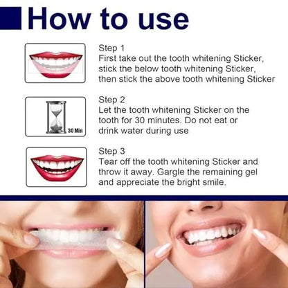 Teeth Whitening Strips Kit