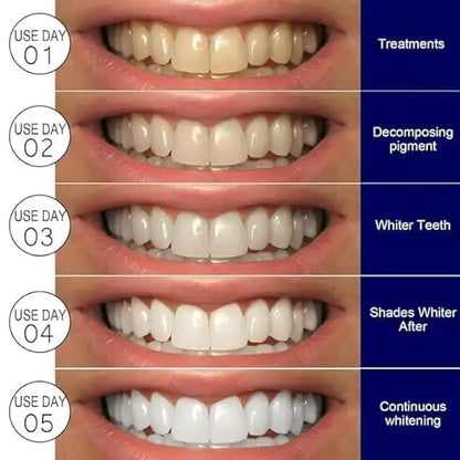 Teeth Whitening Strips Kit